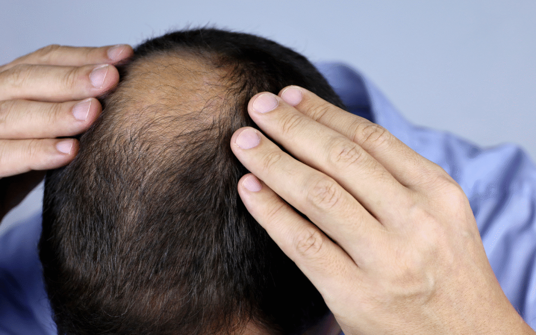 Capelli: perchè si indeboliscono e cadono?